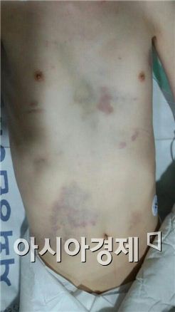 "우리 애 온 몸에 피멍이…" 인천 장애인 의문사 의혹