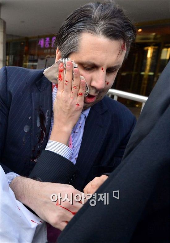 리퍼트 美대사, 괴한에 얼굴 피습·큰 부상…용의자 검거(3보)