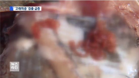 위벽 뚫는 고래회충? 방송 나온 벌레 실체는…
