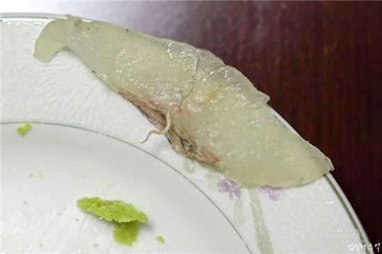 위벽 뚫는 고래회충? 방송 나온 벌레 실체는…