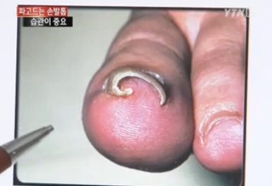 사진=YTN 방송 캡처