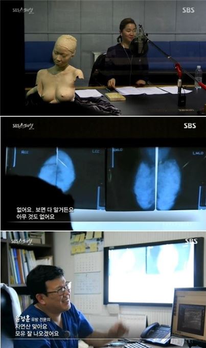 'SBS 스페셜' 장윤주, 가슴 사이즈 C컵…"고도의 치밀 유방"