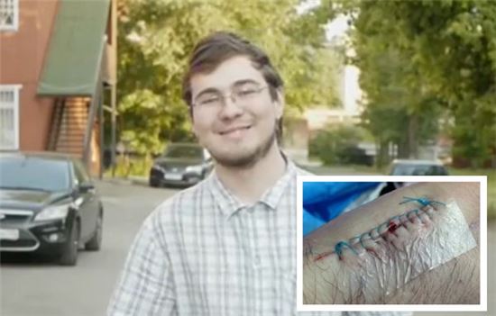 교통 카드 몸에 심은 남자 '극혐'