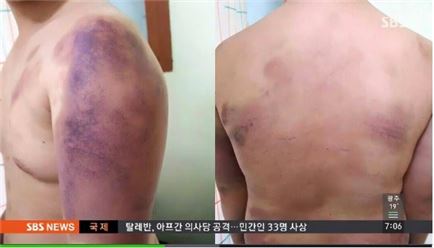 경산 대학생 집단폭행 피해자 父 "금품갈취에 성추행 용서 못해"