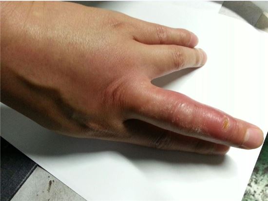 제주서 '맹독 문어' 사고 첫 발생, 증상 보니…"뼈 시리고 마비"