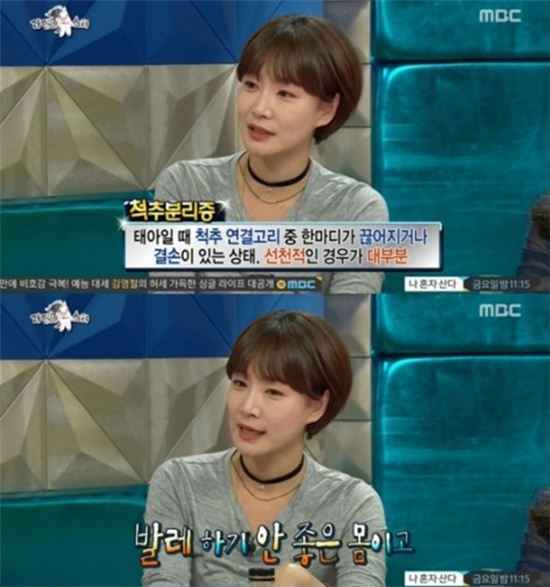 '라디오스타' 박효주 발레리나 꿈 접고 연기자 된 이유 '척추분리증' 