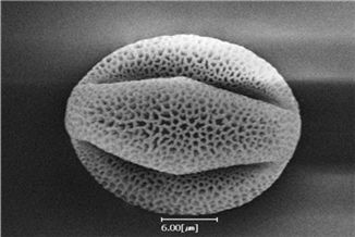 능소화 꽃가루의 전자현미경 사진