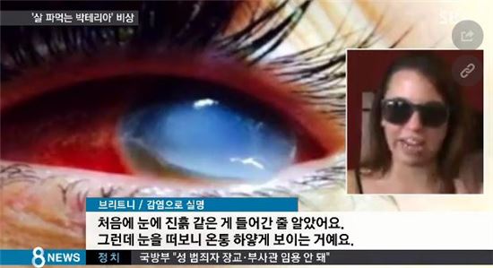 살 파먹는 박테리아. 사진=SBS 방송화면 캡처