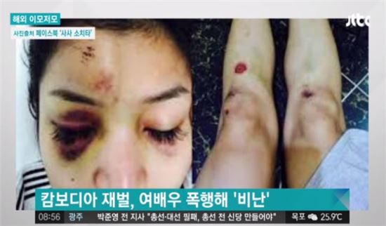 부동산 재벌, 여배우 무차별 폭행…'만신창이 얼굴' 경악