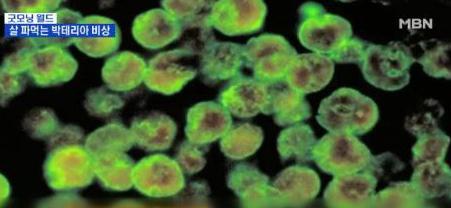 일본 '식인 박테리아' 71명 사망 "아직 항생제도 없어…공포"