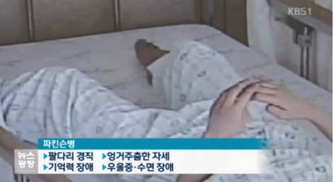 '냄새'로 파킨슨 병 조기 발견한 여성 "사향 같은 향기 나"…의학계 '술렁'