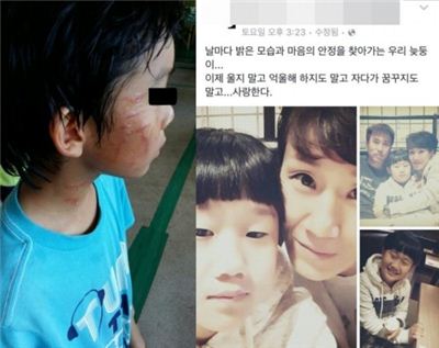 사건 당일 피해 아동(왼쪽)과 사건 후 김병지 아내가 올린 SNS(오른쪽) 사진=온라인 커뮤니티