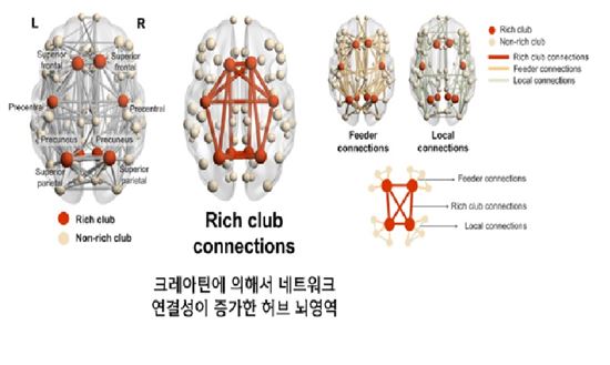 크레아틴과 세로토닌재흡수억제제의 병용요법으로 대뇌 신경망 연결성이 증가하는 허브 뇌영역.(제공=미래부) 
