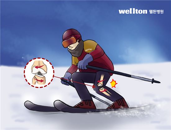 "눈이다!"…스키·보드, 관절 손상 없이 안전하게 즐기려면