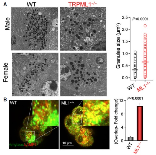 ▲TRPML1 결손 생쥐의 췌장세포에서 나타난 분비성 소포체의 비대화.[사진제공=연세대]

