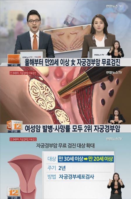 자궁경부암 무료 검진 올해부터 20세 이상 여성 시행. 사진=연합뉴스 TV 캡처