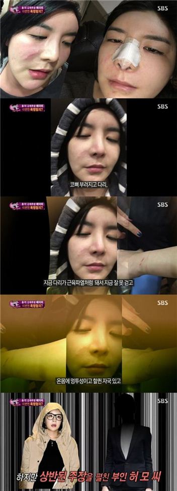 '폭행혐의' 에이미. 사진=SBS '한밤의TV연예' 방송화면 캡처