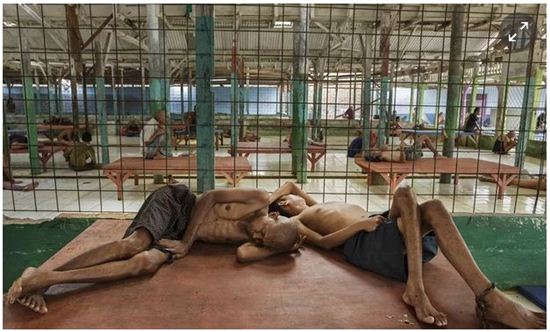 정신질환자 1만9천명 손발 묶고 철창 속에… 印尼  '파숭' 감금행위, 인권기구서 공개