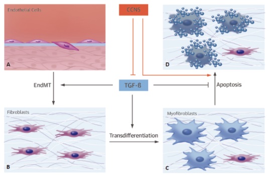 ▲CCN5는 내피세포(A)가 섬유아세포(B)로 분화되는 것과 섬유아세포(B)가 근섬유아세포(C)로 분화되는 것을 억제하는 기능을 한다.[사진제공=GIST]  
