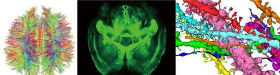 ▲뇌신경망 구조, 투명 뇌지도, 전자현미경 뇌지도(왼쪽부터).[사진제공=한국뇌연구원]
