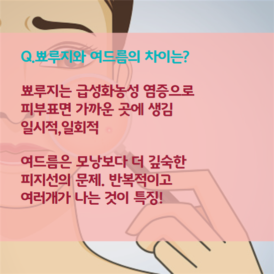 [카드뉴스]모르지? 불쑥 찾아온 뾰루지 이별법
