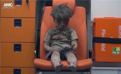 시리아 내전, 격전지서 구조된 피범벅 5살 꼬마…세계를 울리다