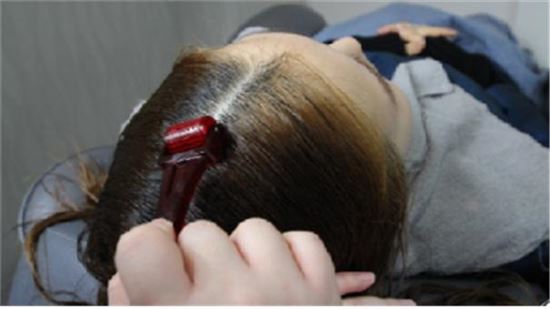한 여성이 불법 두피탈모관리전문점에서 시술을 받고 있다. (사진=서울시 제공)