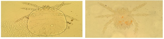 ▲쯔쯔가무시증을 매개하는 털진드기. 활순털진드기(왼쪽), 대잎털진드기.[사진제공=질병관리본부]
