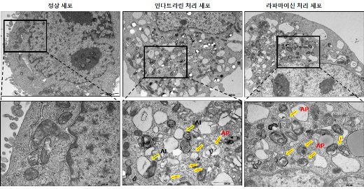 ▲인다트라린과 기존의 오토파지 유도 약물로 알려져 있는 라파마이신을 세포에 처리했을 증가하는 자가 소화 액포 (autophagic vacuole)을 전자현미경을 통해 관찰한 이미지.[사진제공=미래부]