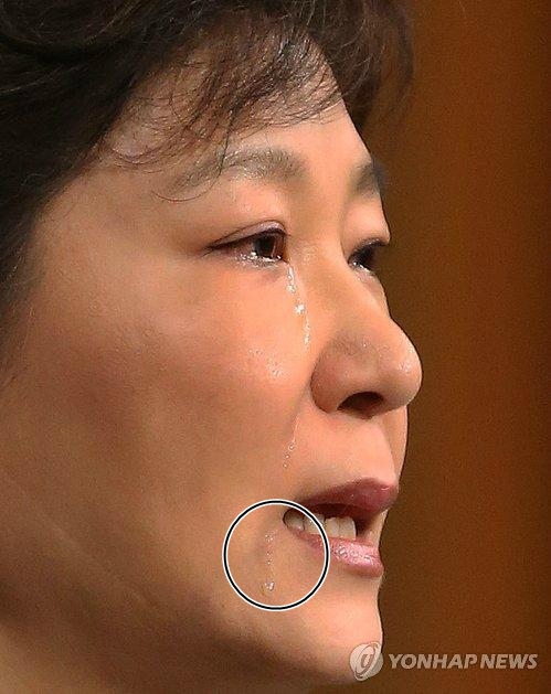 박근혜 대통령 2014년 5월19일 세월호 참사 관련 대국민담화 발표 당시. 피멍 자국이 선명하던 2014년 5월13일로부터 6일이 지난 시점. 희미하지만 피멍 자국이 여전히 남아있다, 사진=연합뉴스