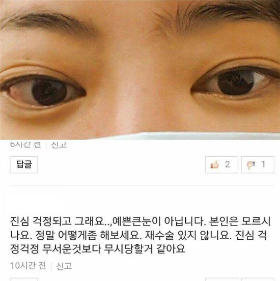 서유리 “앞트임 안했습니다, 그레이브스병으로 안구돌출 치료받고 있다”