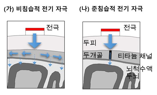 ▲준침습적 뇌자극 방법에 대한 효과가 입증됐다.[사진제공=GIST]