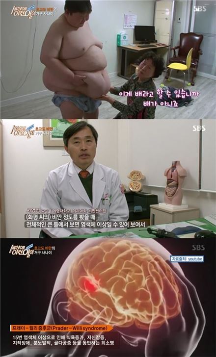 '세상에 이런 일이'에서는 초고도비만을 앓고 있는 김화평(29)씨의 사연이 공개됐다/사진= SBS ‘순간포착 세상에 이런 일이’ 방송 캡처 