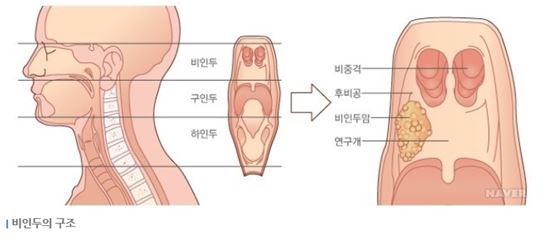 김우빈 투병, 비인두암은 어떤 병?