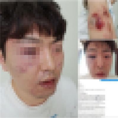 성동경찰서, 엉뚱한 시민 폭행 논란…“위법사실에 엄중 조치할 것”