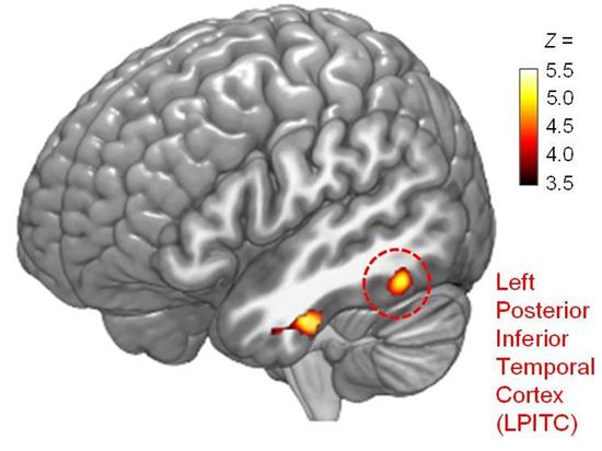 ▲이른바 뇌의 '별세포'가 언어 학습 능력에 영향을 끼치는 것으로 밝혀졌다.[사진제공=미래부]