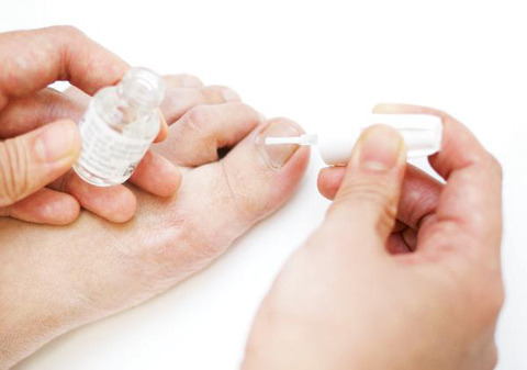 근질근질…돌아온 무좀의 계절