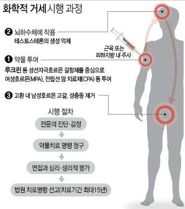 화학적 거세 시행 과정. 사진=법무부, 연합뉴스 제공