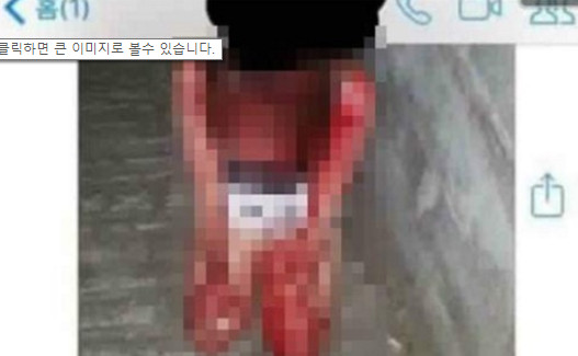 또래 중학생에게 집단 구타를 당해 온몸이 피투성이가 된 피해 학생/사진=인터넷 커뮤니티