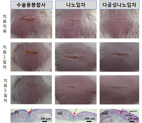 [백조실험실16]상처 치료후 사라지는 나노입자 