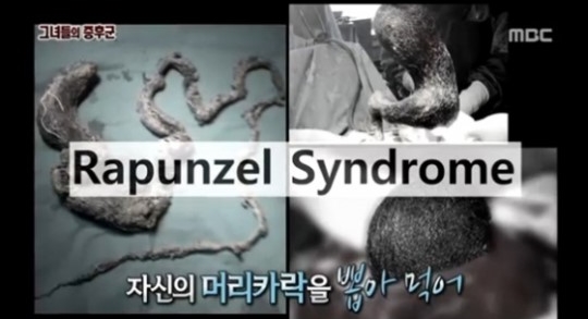[사진출처=MBC '서프라이즈']