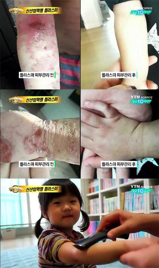 '황금나침반', 아토피 원인 치료·성인 좁쌀 여드름 없애는 법...핵심은 '이것'