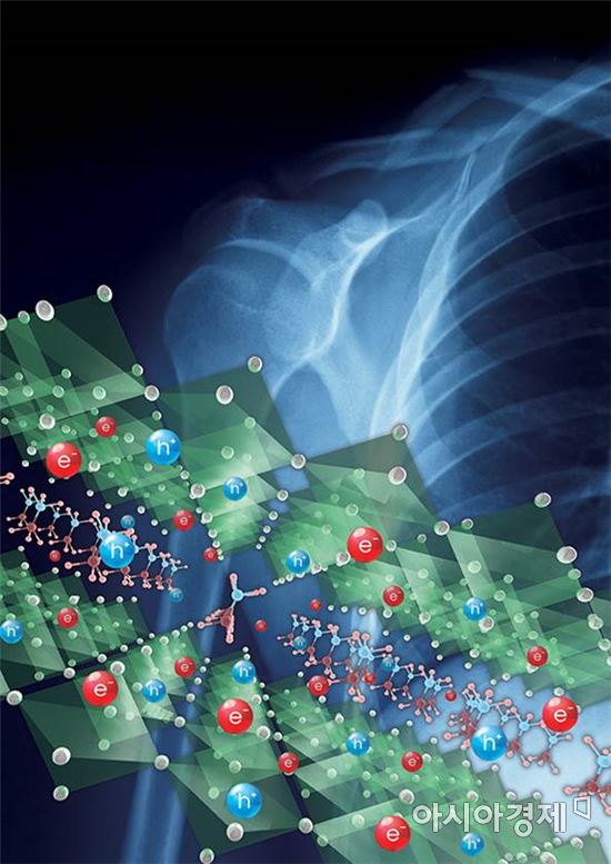 삼성전자, 방사선 피폭량 90% 줄인 엑스레이 소재 개발