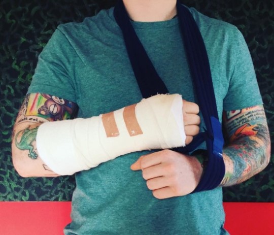 에드 시런, 팔 부상으로 29일 내한 공연 ‘불투명’