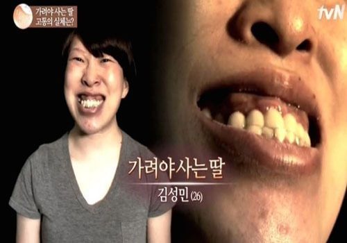 터너증후군. 사진=tvN '렛미인5' 캡처
