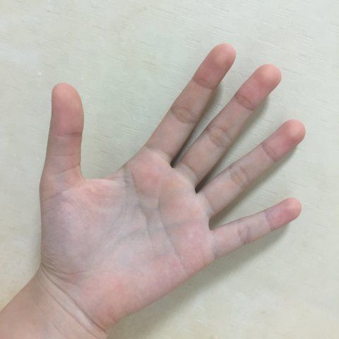 “얘들아 나 엘사인가봐” 만지기만 하면 파랗게 물드는 손