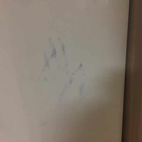 “얘들아 나 엘사인가봐” 만지기만 하면 파랗게 물드는 손