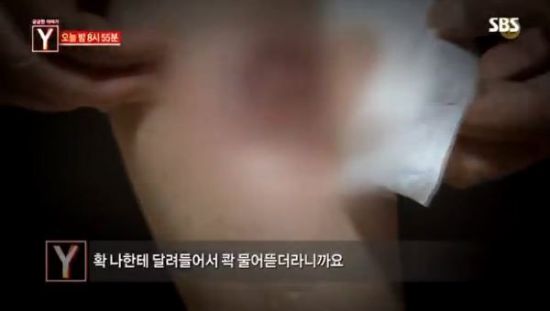 ‘부산행’ 좀비가 현실로? 서울 한복판에 출연한 ‘좀비 괴한’의 정체