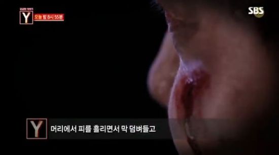 ‘부산행’ 좀비가 현실로? 서울 한복판에 출연한 ‘좀비 괴한’의 정체