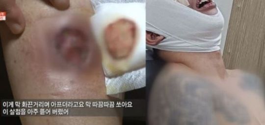 사진=SBS ‘궁금한 이야기 Y’